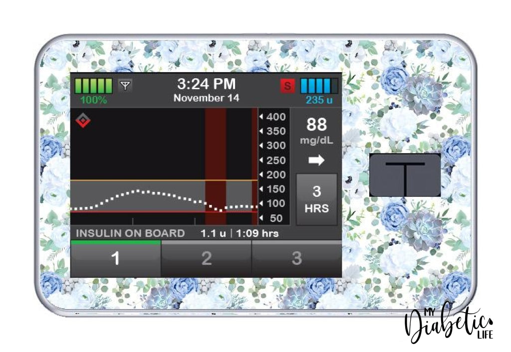 Blue Succulents - Tandem Tslim X2 Pump Peel Skin And Decal Insulin Pump Sticker T:slim